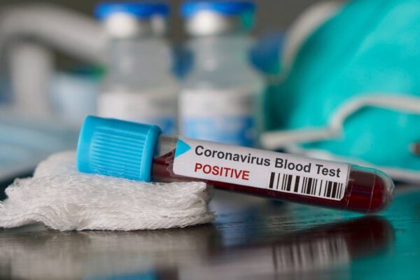 CORONAVIRUS: Situația epidemiologică la Cluj. 12 cazuri noi și un deces nou