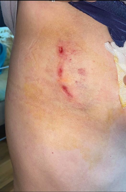 Femeie sfășiată de câini în Florești! Primarul acuzat că nu combate fenomenul câinilor fără stăpâni