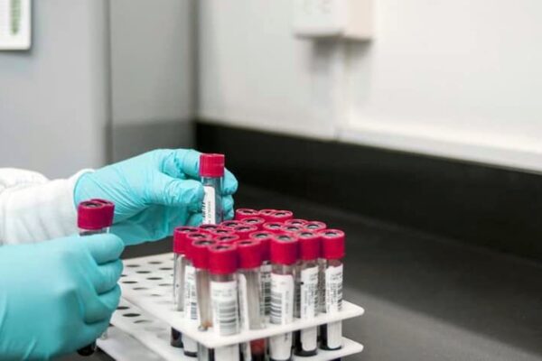 Unde puteți face analize medicale gratuite. Un mare spital din Cluj Napoca a făcut anunțul