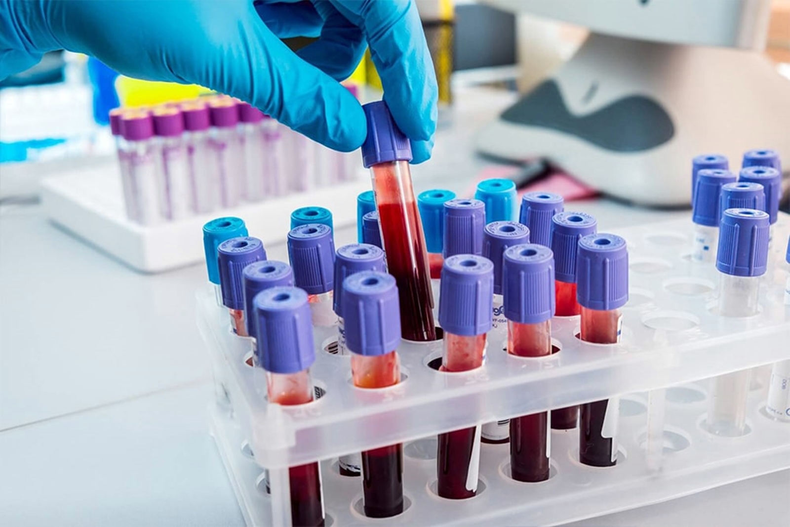 Achitare pentru o asistenta medicala acuzată că măsluia rezultatele la alcoolemii