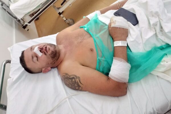Mai avem Poliția și Procuratură în județul Cluj? Un bărbat din Cojocna, bătut cu bestialiate de doi agresori. De doi ani, Poliția se chinuie să îi găsească, deși aceștia stau la doi pași de Postul de Poliție