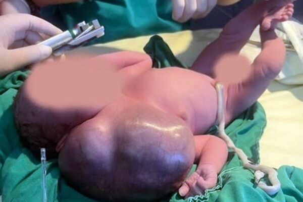 Miracol la Cluj. Medicii clujeni de la Spitalul de Pediatrie Cluj au reușit imposibilul